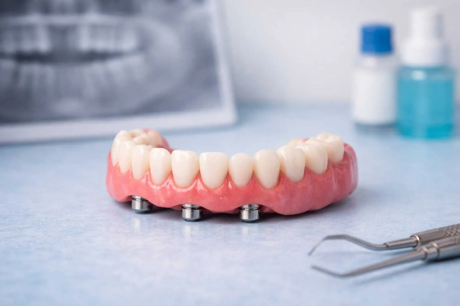 Yeni Başlayanlar İçin implant üstü protez Rehberi: Süreç ve Bakım